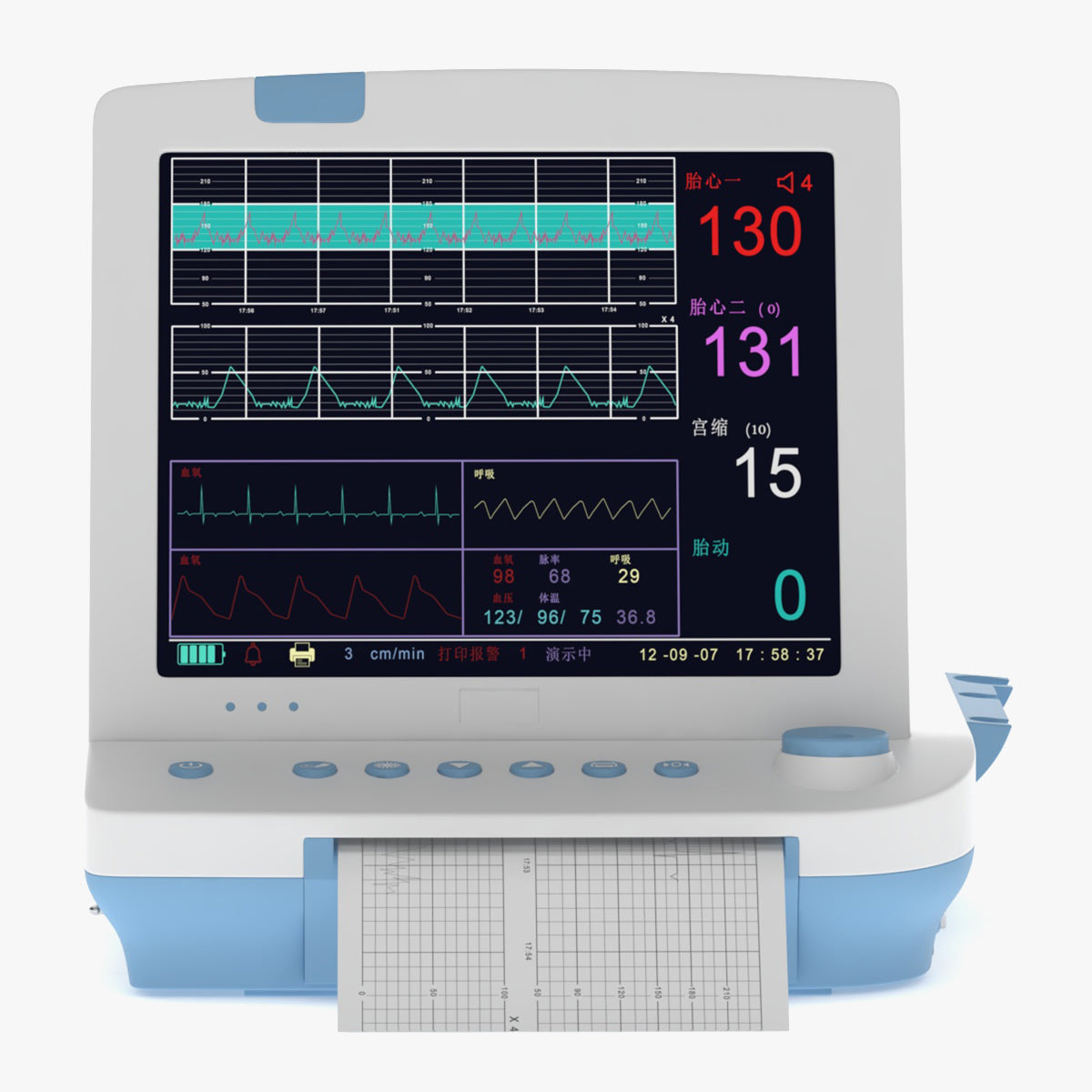 Medical Maternal Monitor